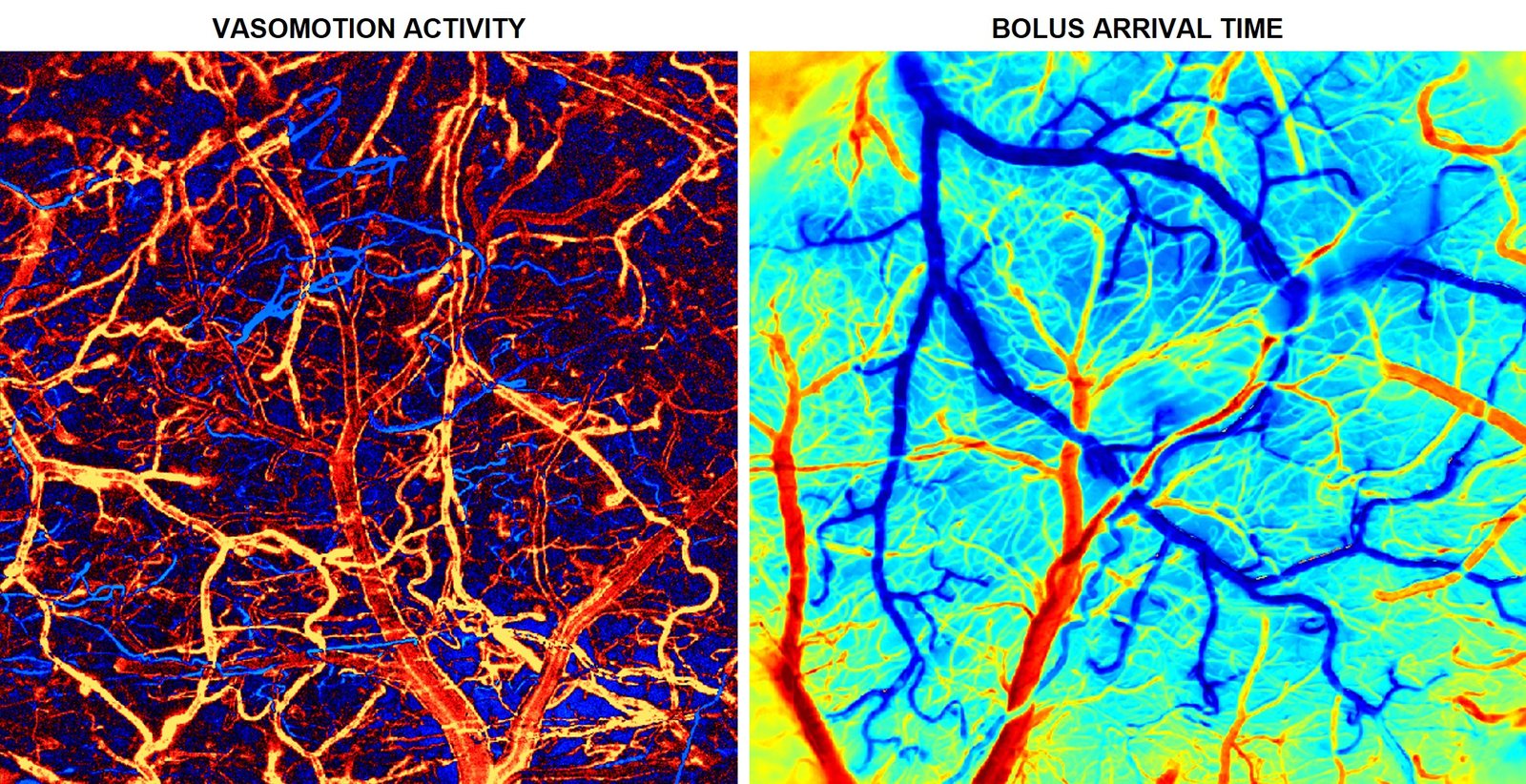 Wide-field fluorescence maps of vasomotion activity and bolus arrival time in the mouse cortex