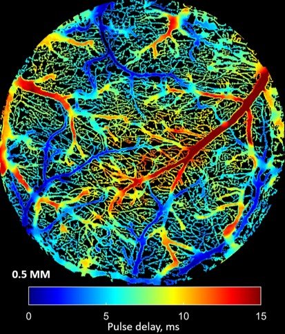 High-Speed LSCI blood flow index of the mouse cortex