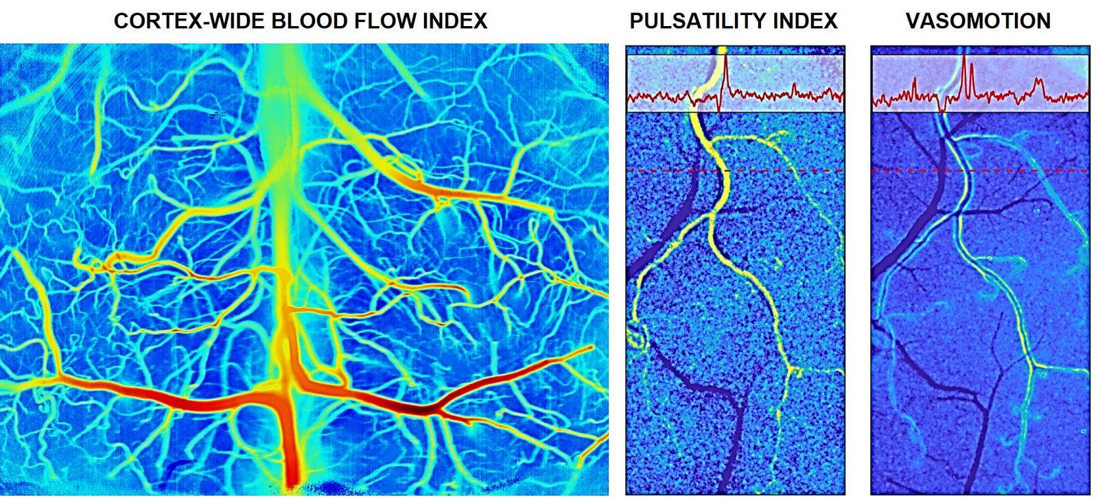 LSCI metrics of cortex-wide blood flow index, pulsatility and vasomotion in the awake mouse
