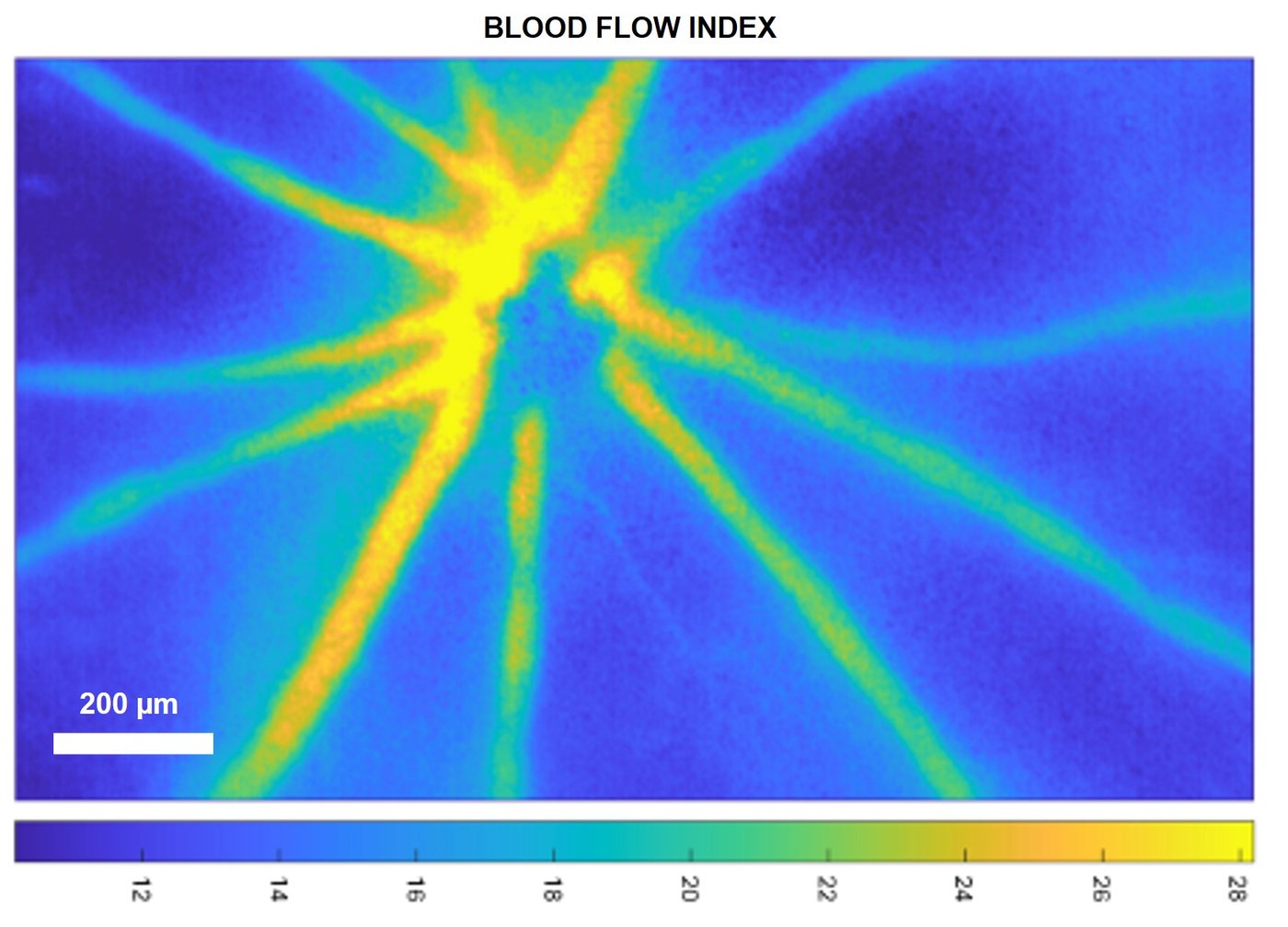 LSCI blood flow index map of the mouse retina