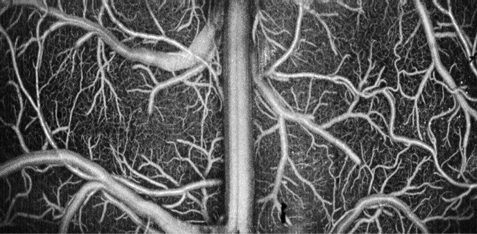 OCT angiogram of the mouse cortex