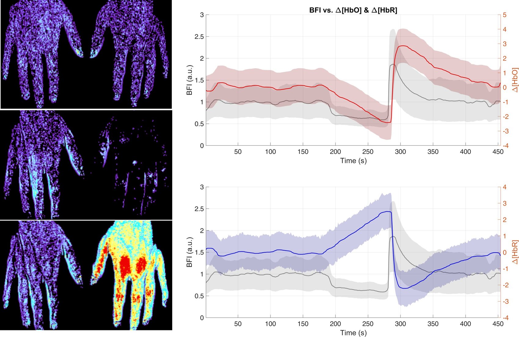 Human skin perfusion and oxygenation imaging with reactive-hyperemia traces