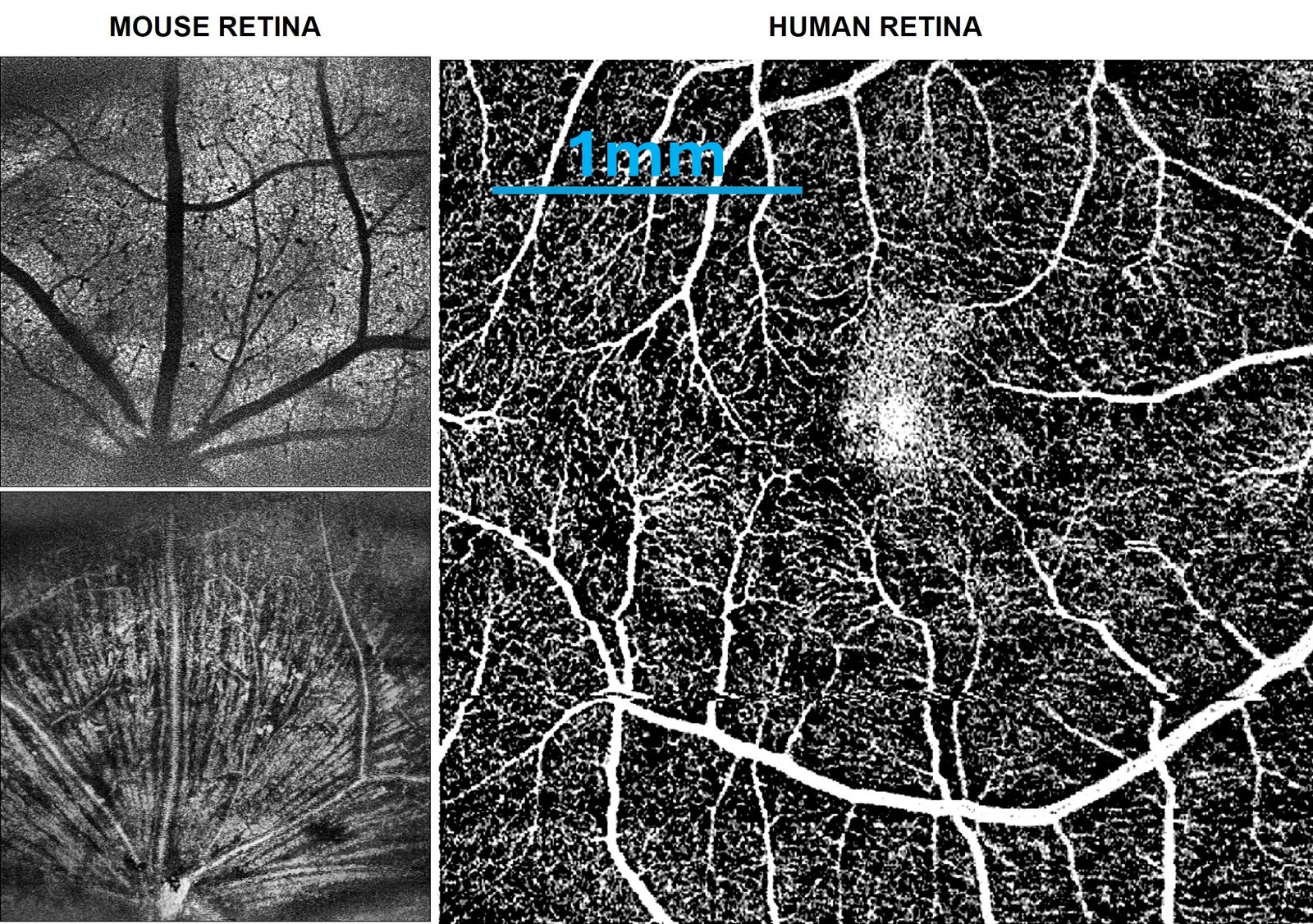 Mouse and human retinal visible-light OCT images